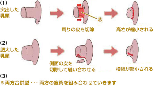 陥没乳首 貧乳 Amebaブログ